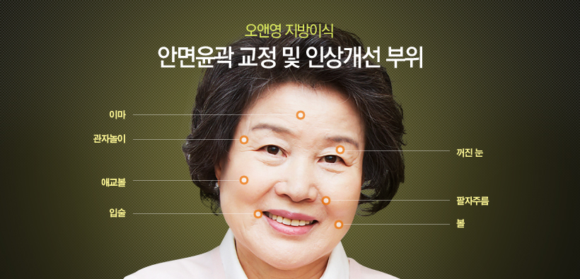 명품지방이식 오앤영줄기세포 성형, 얼굴성형효과, 피부톤개선, 주름개선