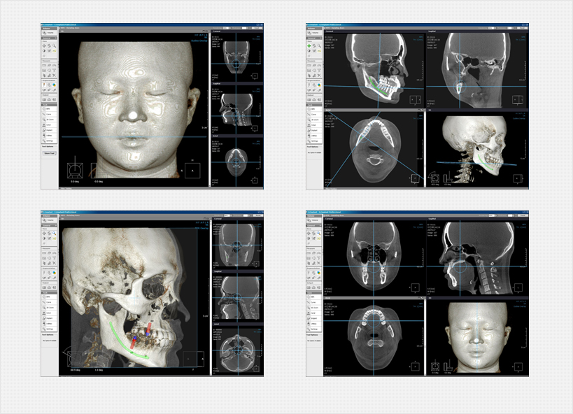 입체적인 정밀분석 3D CT 자료 